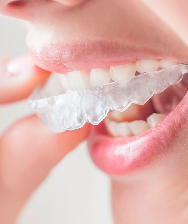 Invisalign Salamanca