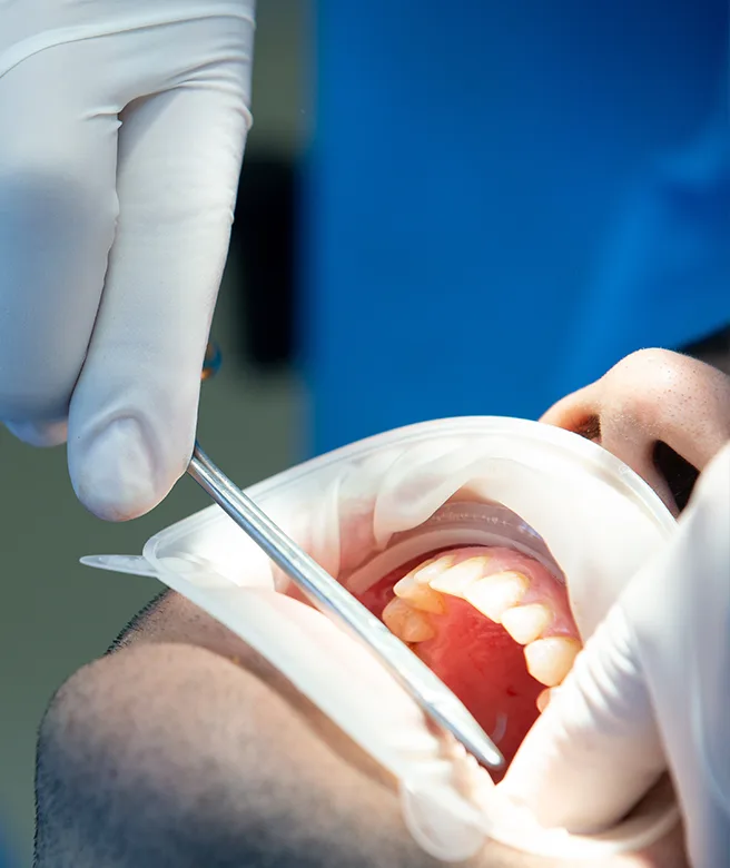 cirugia-oral-salamanca