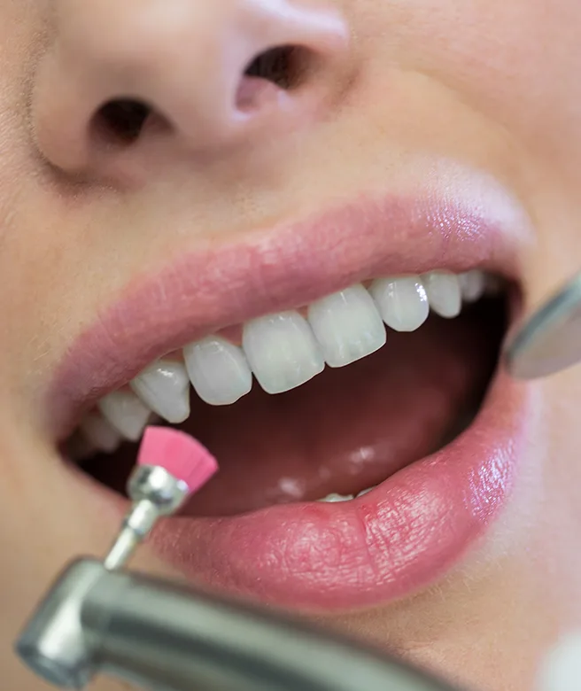 operatoria-dental-salamanca